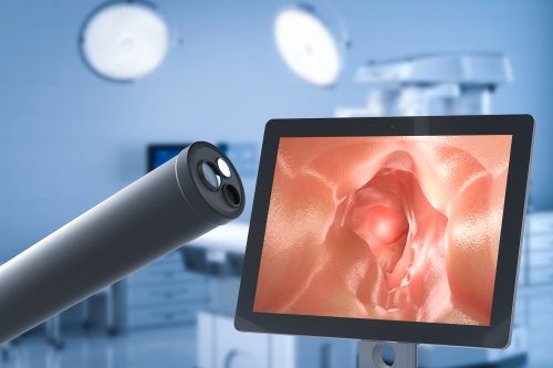IMED German Clinic - Colonoscopia