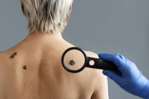 IMED German Clinic - Dermatología en Marbella
