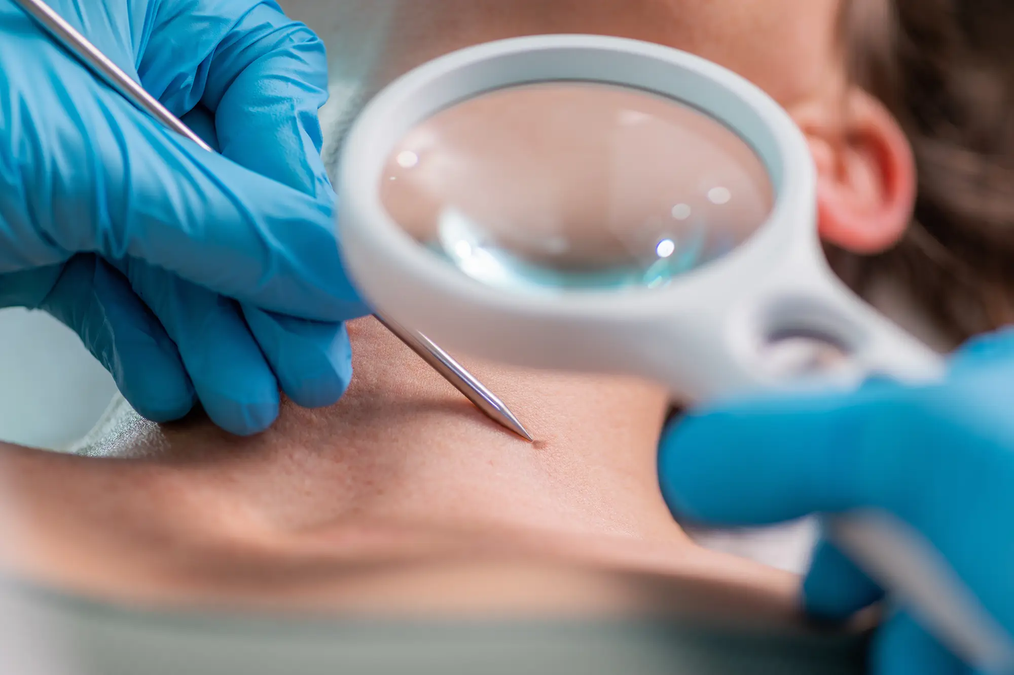 IMED German Clinic - Dermatologo en Marbella