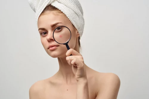 Dermatología en Marbella